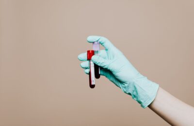 Testosteronul la menopauză nu are încă un beneficiu dovedit pentru memorie