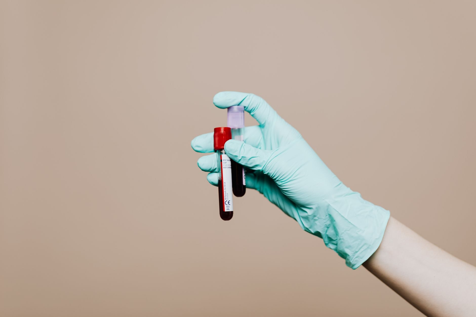 Analize pentru testosteronul la menopauză